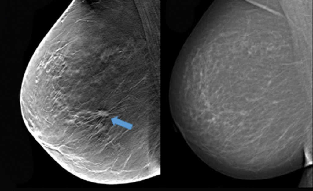 f6458181-69c7-4eb7-8c74-2626acc2c68e.jpg f6458181-69c7-4eb7-8c74-2626acc2c68e.jpg